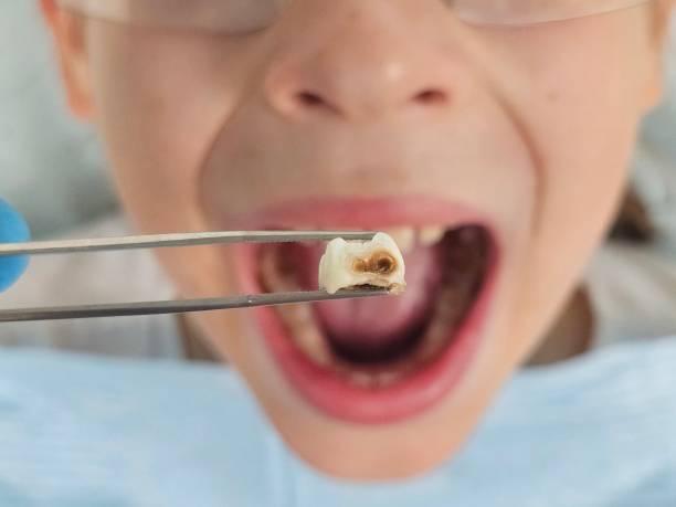 Best Emergency Pediatric Dental Care in Seyur, MO